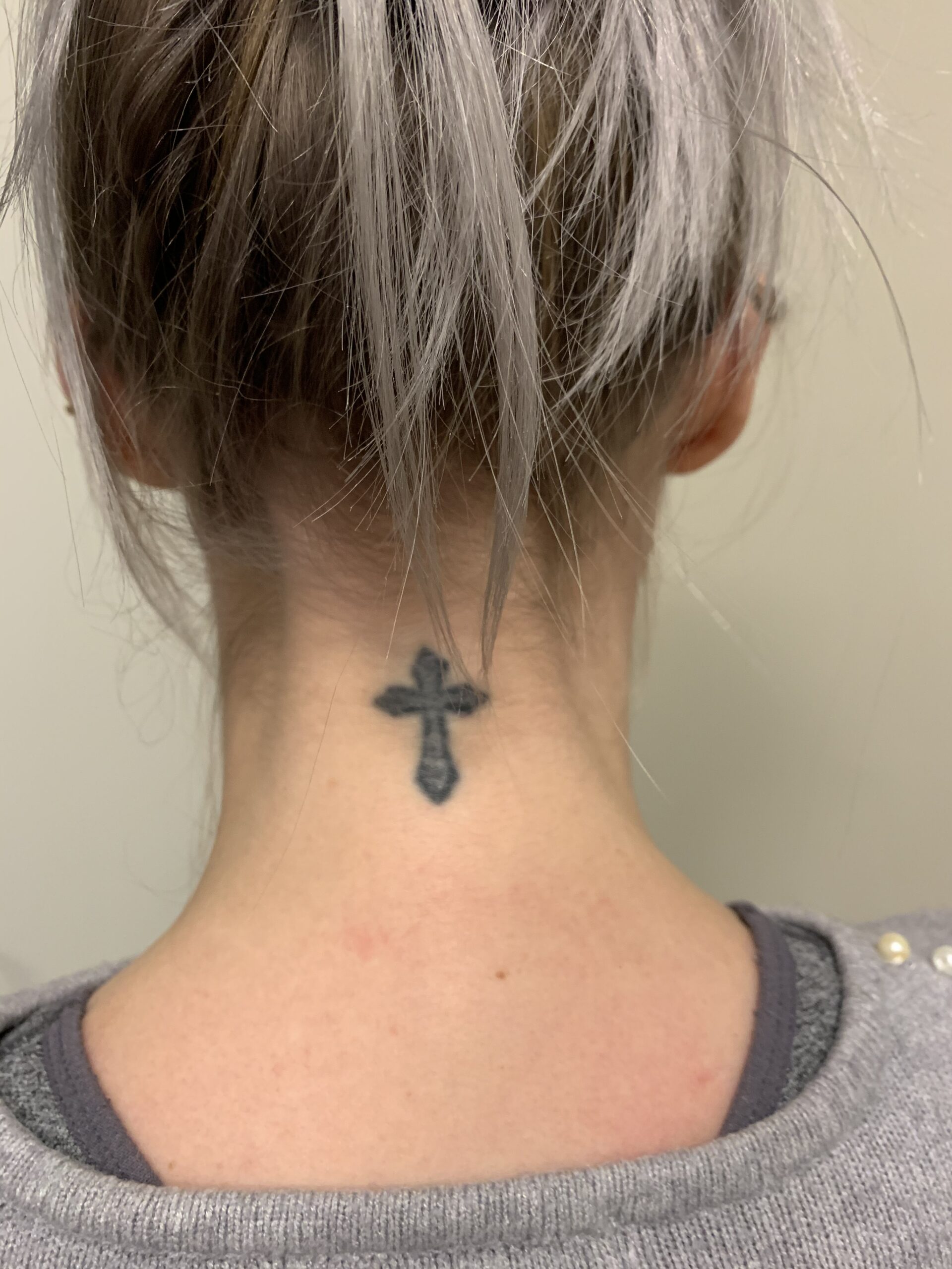 Lille gammel kors-tatovering i nakken før cover-up